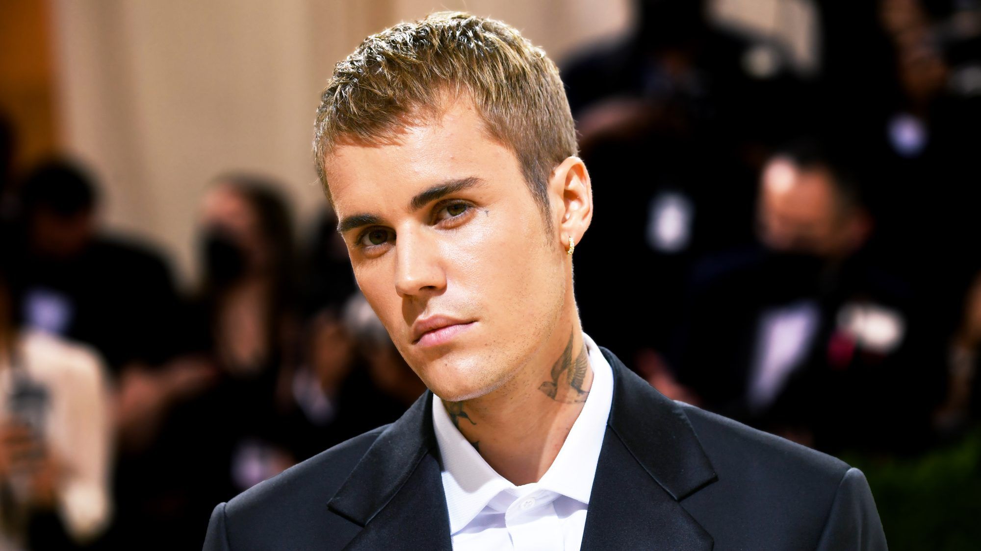 Wie bekommt man ein Ramsay-Hunt-Syndrom?  Justin Biebers Zustand, erklärt