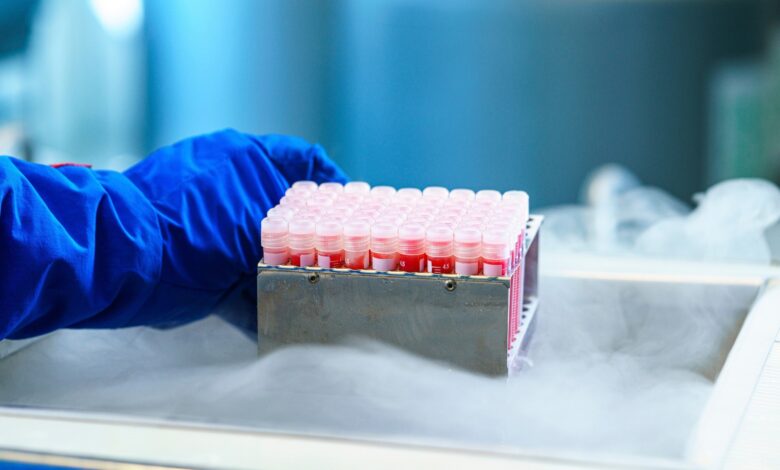 Study: Validation of a SARS-CoV-2 RT-PCR assay: a requirement to evaluate viral contamination in human semen. Image Credit: Leonidovich/Shutterstock