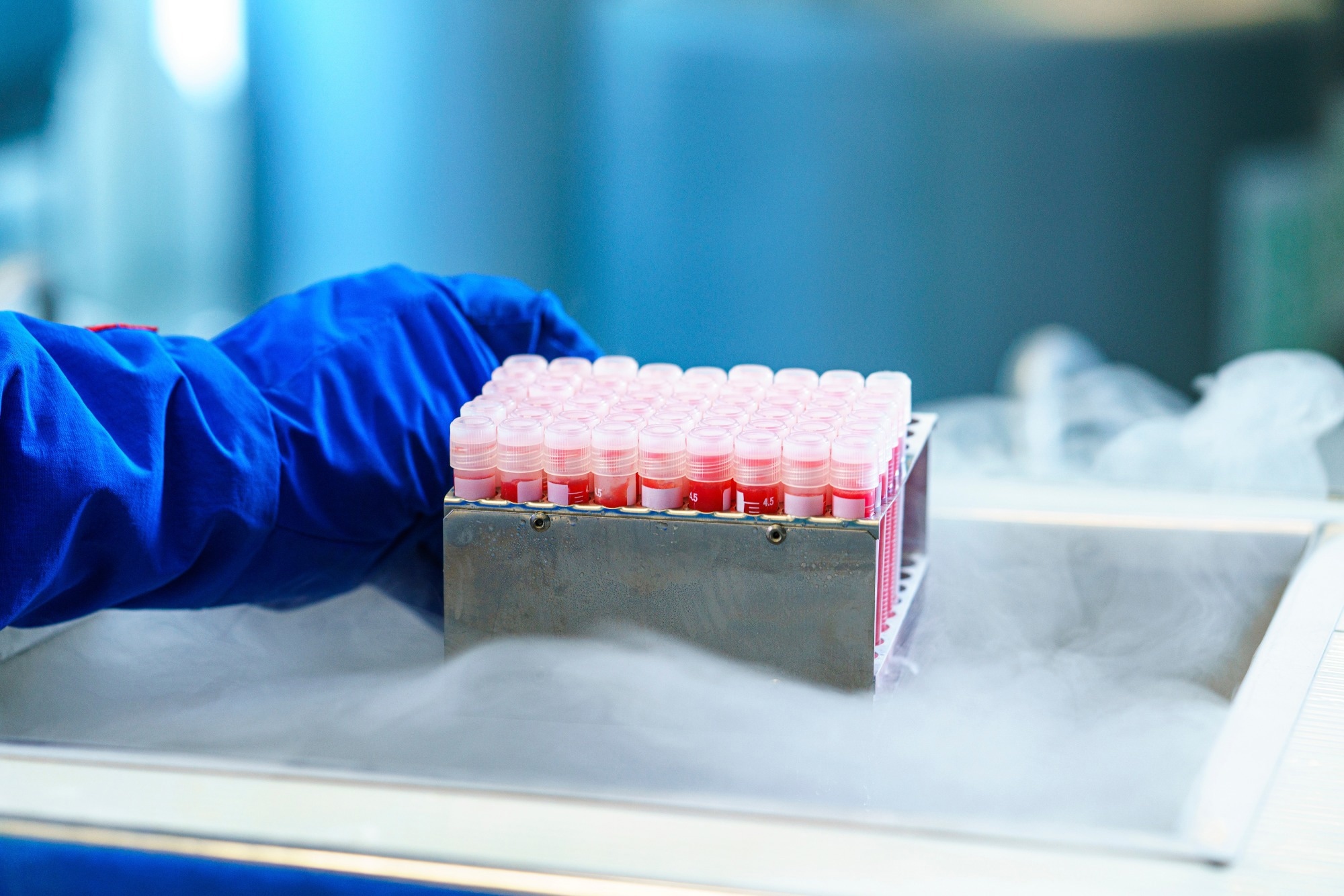 Welche Wirksamkeit haben RT-PCR-Assays zum Nachweis von SARS-CoV-2 im menschlichen Sperma?