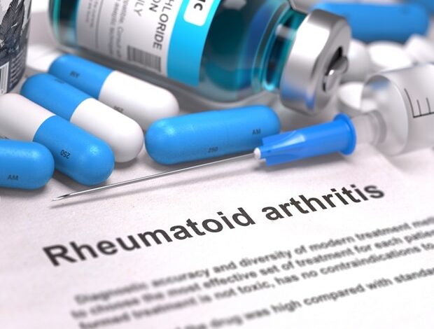 Wissenschaftler verwenden einen systembiologischen Ansatz, um molekulare Akteure bei rheumatoider Arthritis zu identifizieren