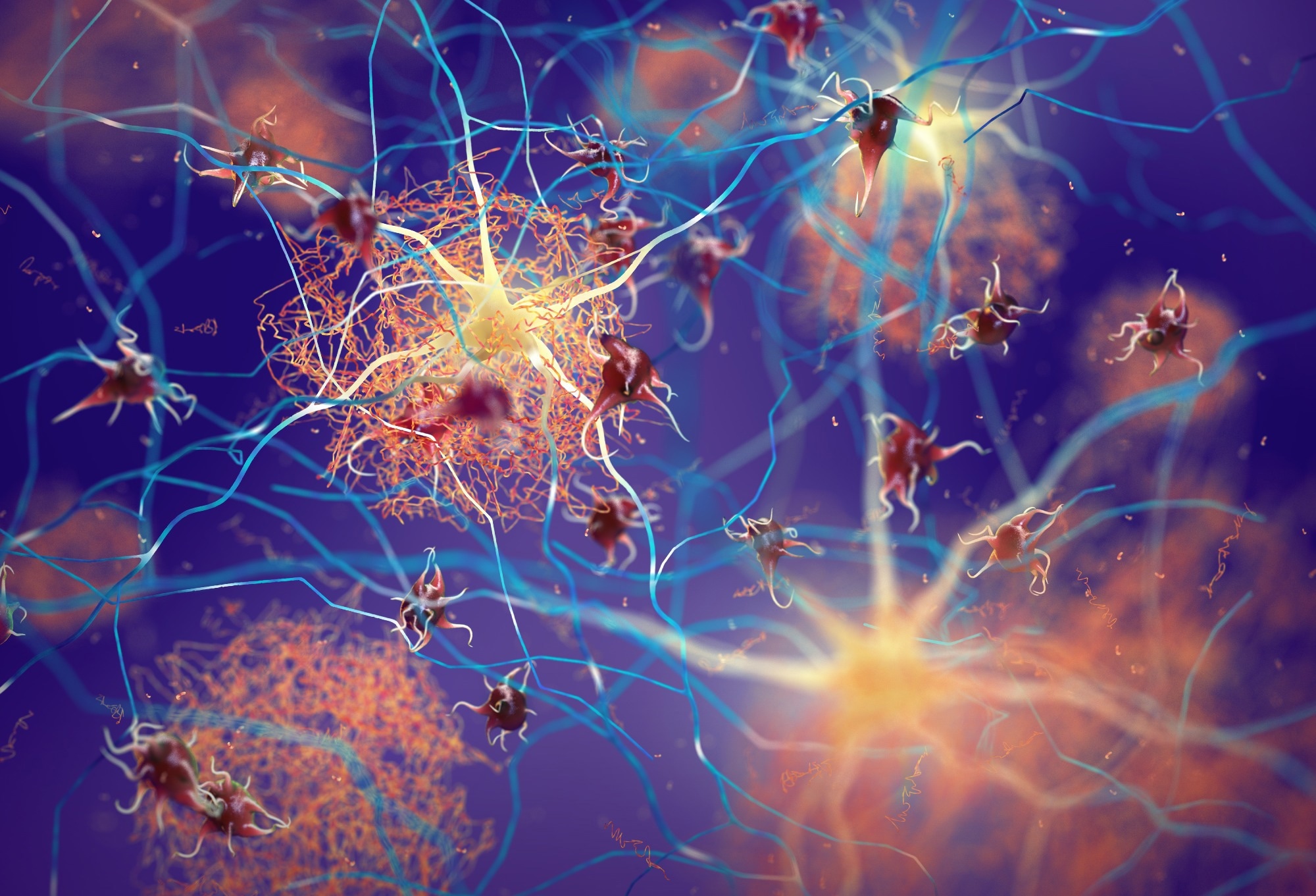 Zeitlich begrenztes Essen kann Alzheimer zugute kommen