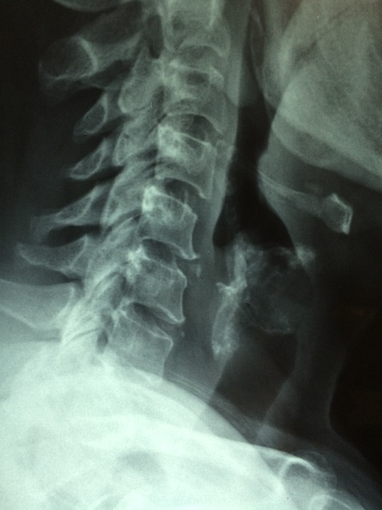 Schilddrüsenunterfunktion: Diagnose und Behandlung